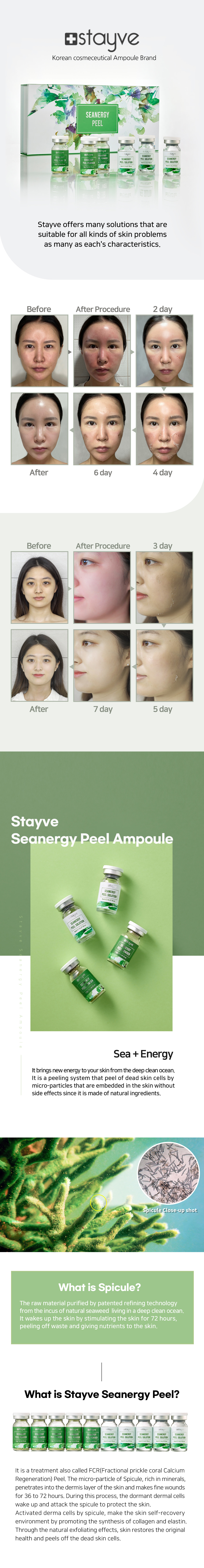 Stayve Seanergy Peel Ampoule 6
